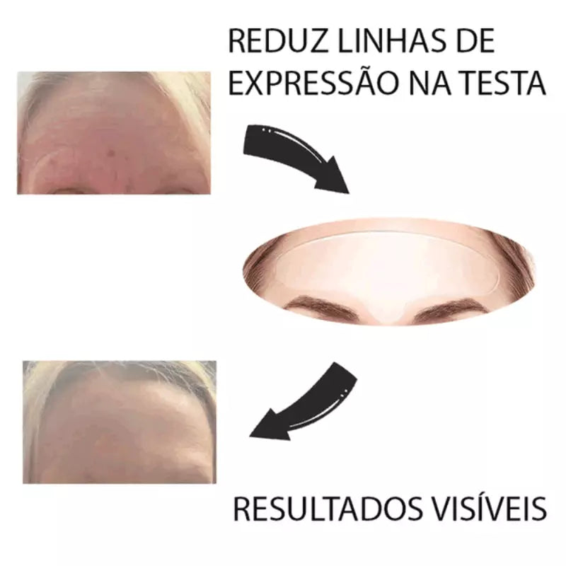 Adesivos de Silicone Sync - Anti Rugas e Expressões