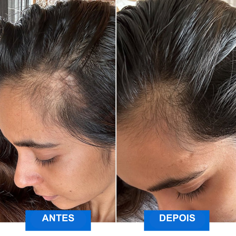 Massageador Capilar e Corporal RelaxSync - Livre-se do Estresse e Restaure seu Cabelo