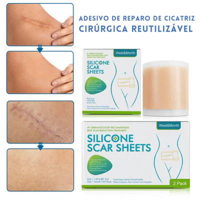 Fita Removedora de Estrias e Cicatriz - SkinSync