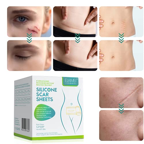 Fita Removedora de Estrias e Cicatriz - SkinSync