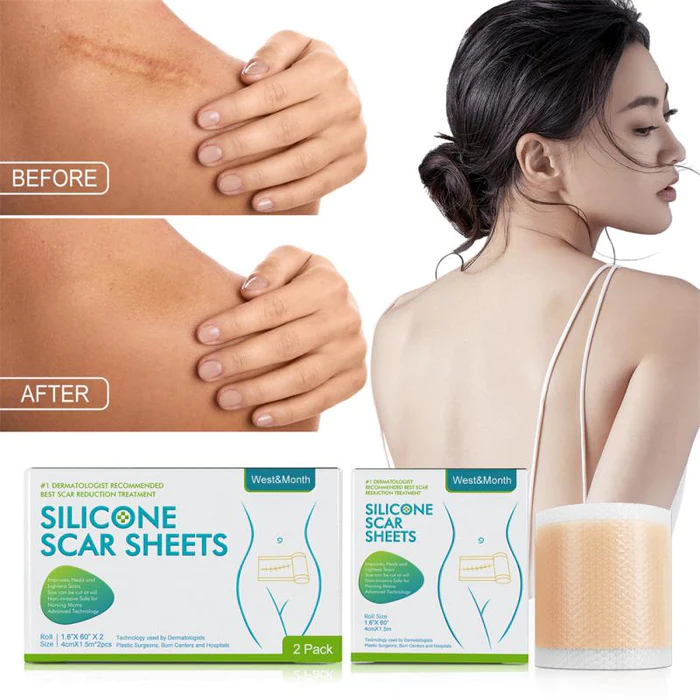 Fita Removedora de Estrias e Cicatriz - SkinSync