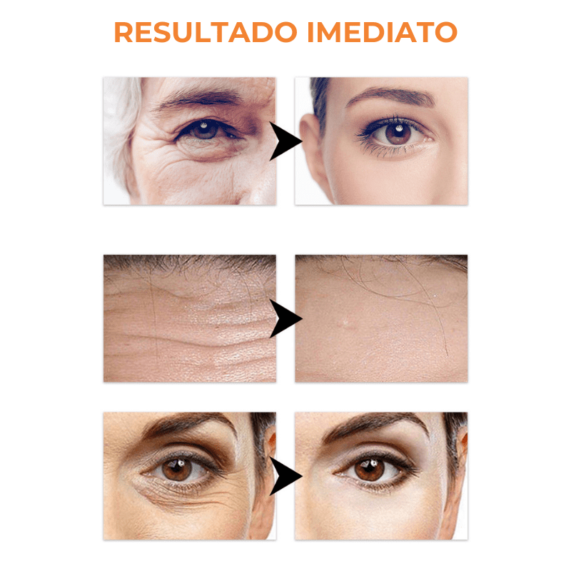 Collagen Skin Botox™ - Máscara de Colágeno Que Revitaliza Pele e Rugas [ATIVOS DO BOTOX] +BRINDE