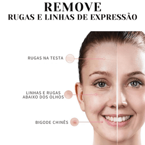 Collagen Skin Botox™ - Máscara de Colágeno Que Revitaliza Pele e Rugas [ATIVOS DO BOTOX] +BRINDE